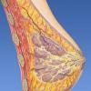 Noduli nella ghiandola mammaria: cause, metodi diagnostici, malattie comuni, trattamento e autoesame